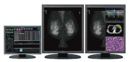 画像診断システム 
最新型カラーディスプレイ搭載 クライム「mammary」